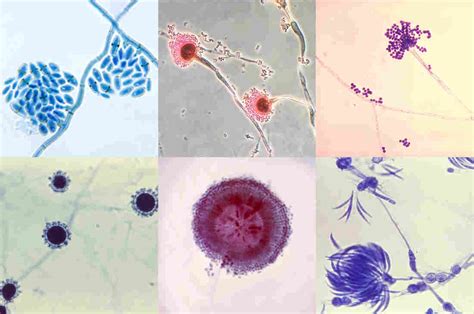 are fungi similar to huamsn - The Human Body's Complicated Relationship With .
